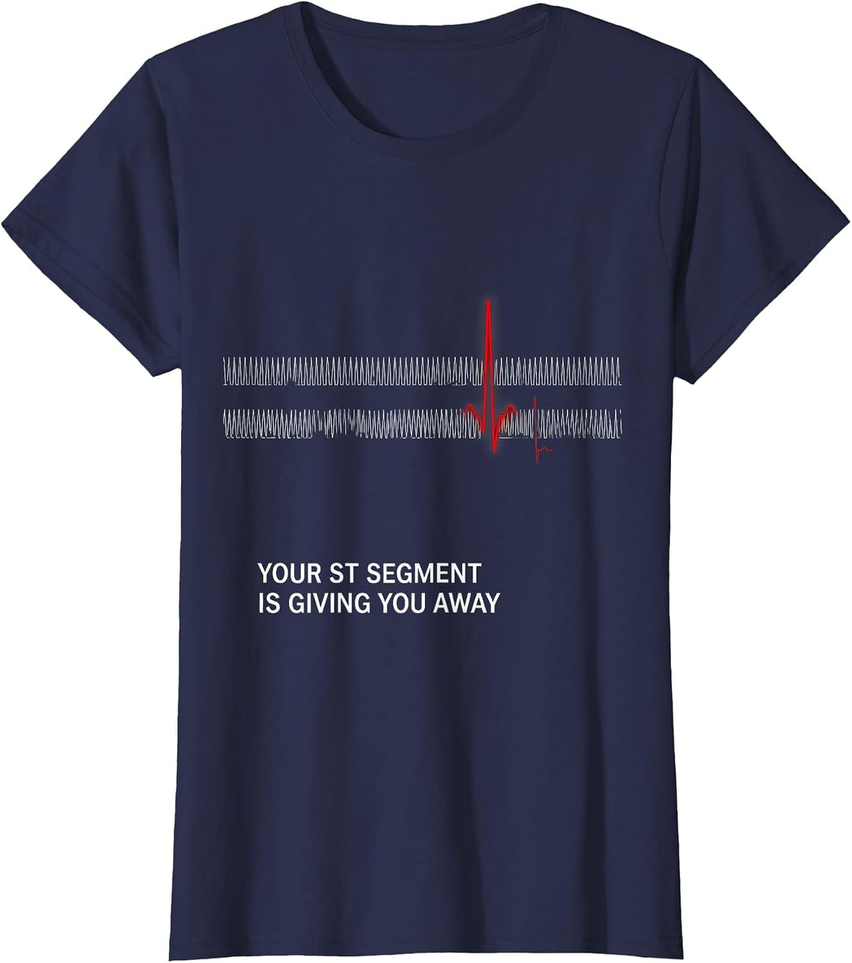 Women's Your ST Segment Is Giving You Away Funny Cardiac Tech EKG T-Shirt - Navy Blue