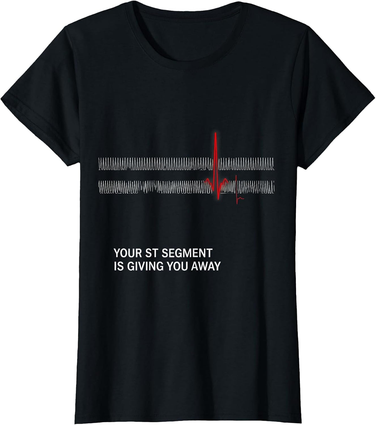 Women's Your ST Segment Is Giving You Away Funny Cardiac Tech EKG T-Shirt - Black