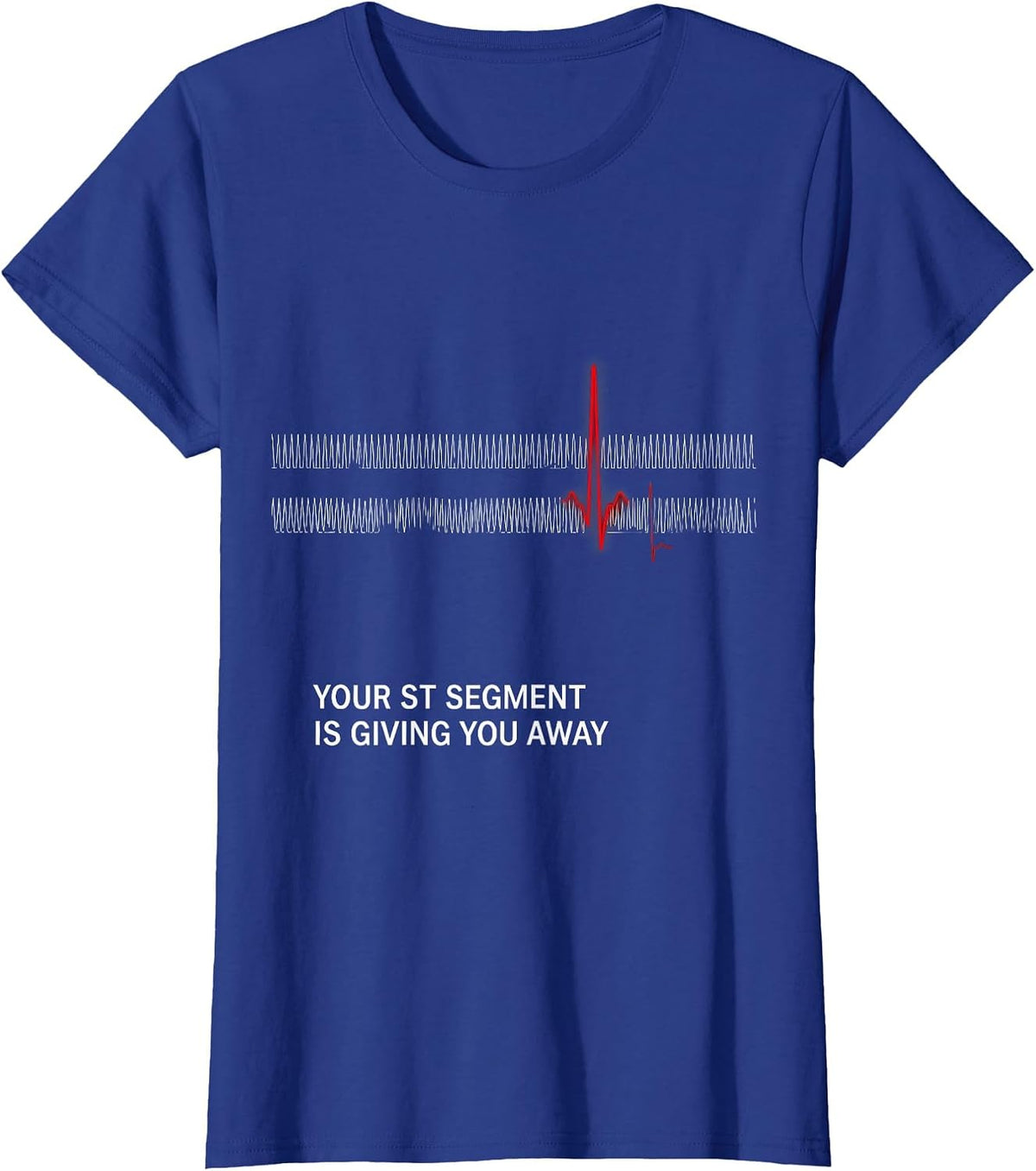Women's Your ST Segment Is Giving You Away Funny Cardiac Tech EKG T-Shirt - Royal Blue