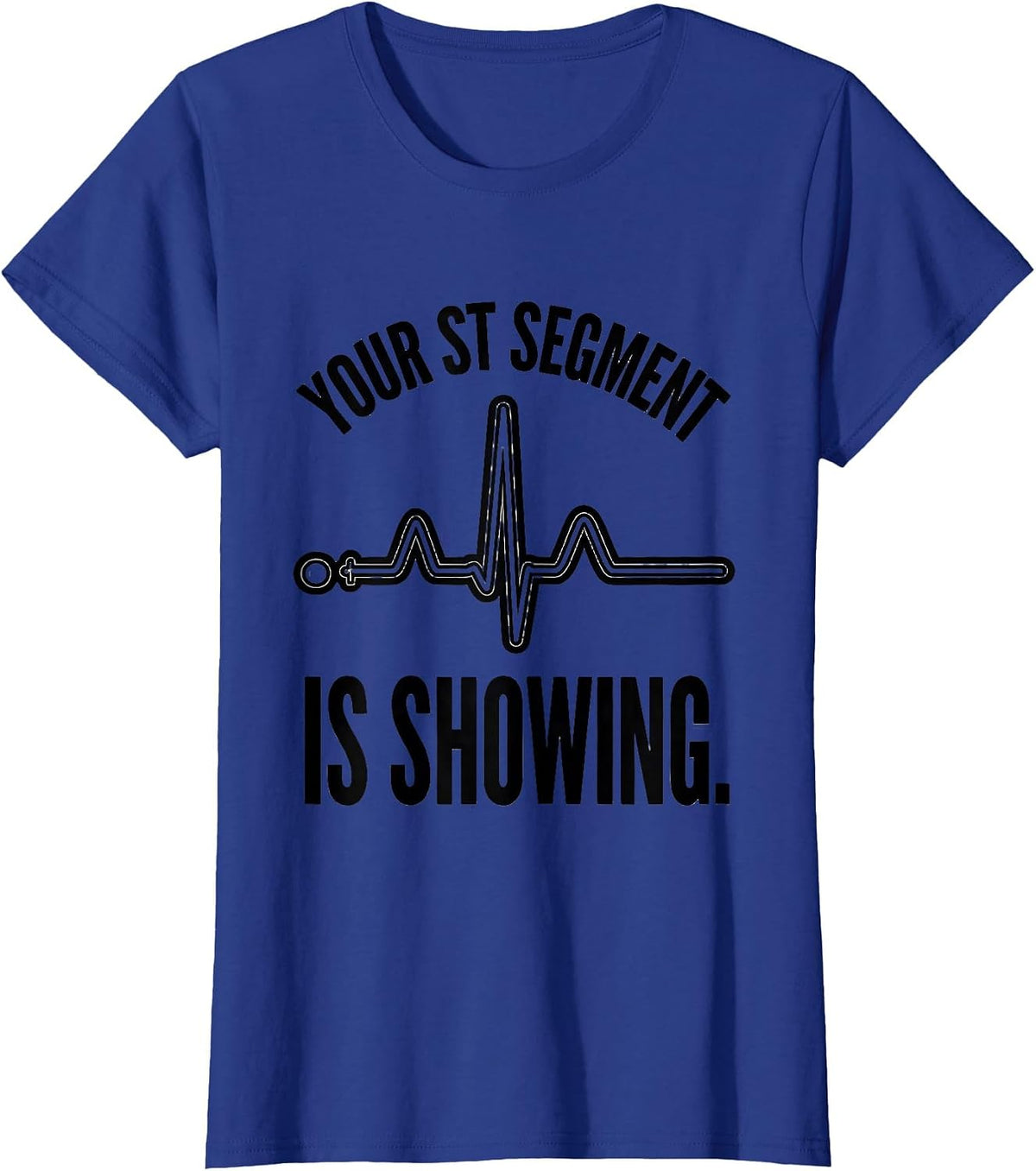 Women's Your ST Segment Is Showing Funny Cardiac Tech EKG Humor T-Shirt - Royal Blue