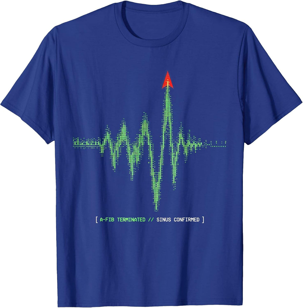A-FIB TERMINATED // SINUS CONFIRMED Funny Cardiology Cardiac T-Shirt - Royal Blue